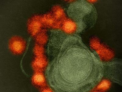 Zika virus from microcephaly case