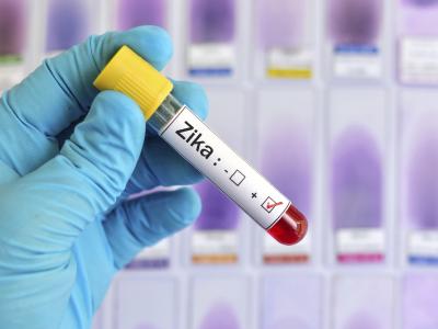 Zika sample