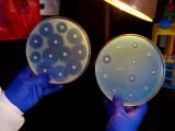 Carbapenem-resistant Enterobacterales
