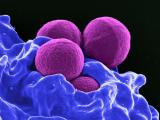 Methicillin-resistant Staphylococcus aureus