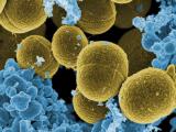 Staphylococcus aureus bacteria