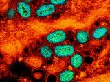 Mpox virus under the microscope