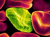 malaria infected rbc