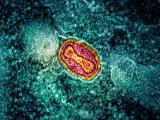 mpox virus 
