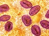 mpox virus 