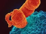 Klebsiella pneumoniae bacteria