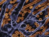 H5N1 virus
