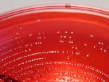 Shigella sonnei