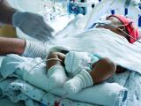 Baby on ventilator