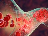 peer reviewed papers on covid 19 Blood clot and platelets