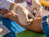 Blood draw