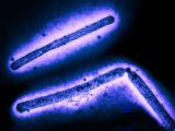 H5N1 virus particles