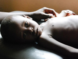 Young boy with HIV