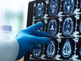 Magnetic resonance brain images