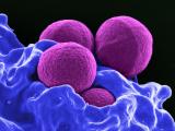 MRSA under the microscope