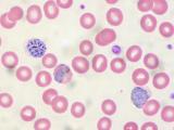 Malaria parasites