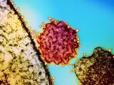 Nipah virus particles