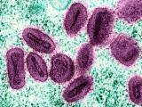 Mpox virus particles