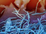 RSV under microscope