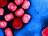 Red mpox viruses