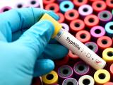 Syphilis test