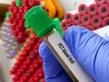 Procalcitonin blood test