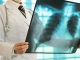 research report on covid 19 for students lung cancer