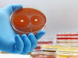 Petri dish with bacterial culture
