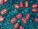 mpox blue purple