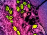 mpox green purple
