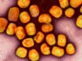 mpox purple orange