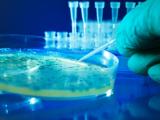 Bacteria culture in petri dish