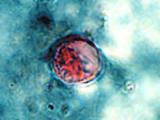 Cyclospora