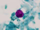 Cyclospora oocyst