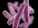 Drug-resistant Shigella