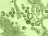 Lassa fever virus