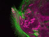 Shigella bacteria