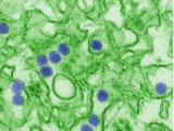 Zika virus