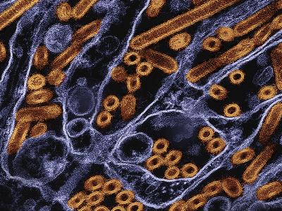 H5N1 virus