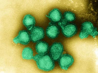 H3N2 virus