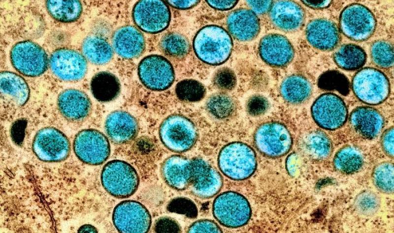 Mpox virus