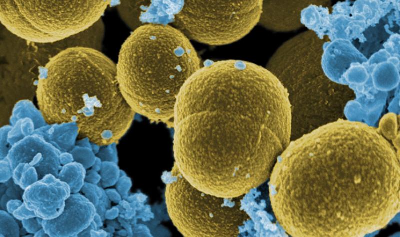 Staphylococcus aureus bacteria