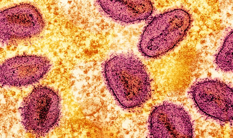 mpox virus 