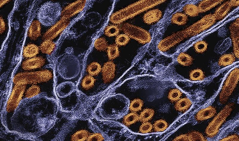 H5N1 detected in Texas dairy herd; researchers can’t pinpoint source of California child’s illness