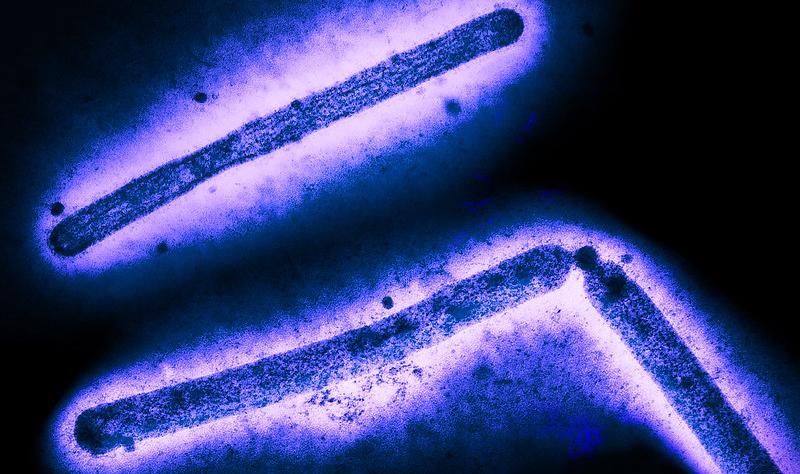 H5N1 virus particles