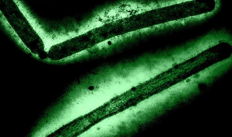 CDC confirms H5N1 in California child as Hawaii details testing results CDC confirms H5N1 in California child as Hawaii details testing results