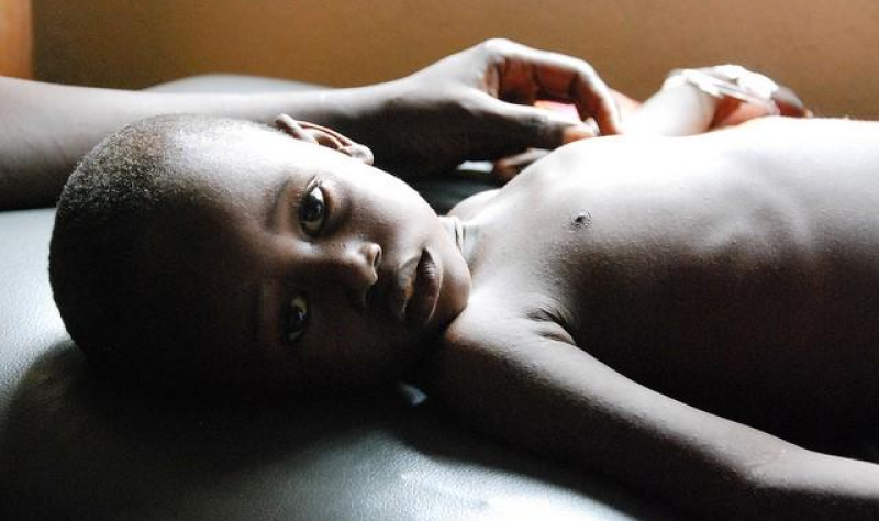 USAID defunding could lead to 14 million deaths worldwide from infectious diseases by 2030