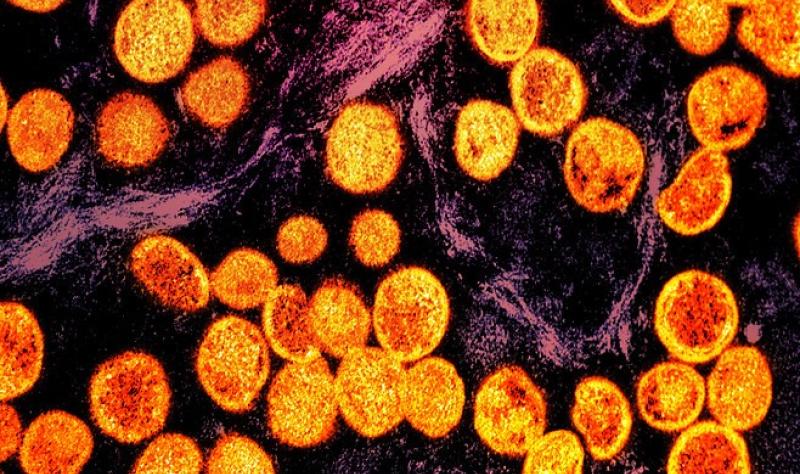Micrograph of mpox viruses