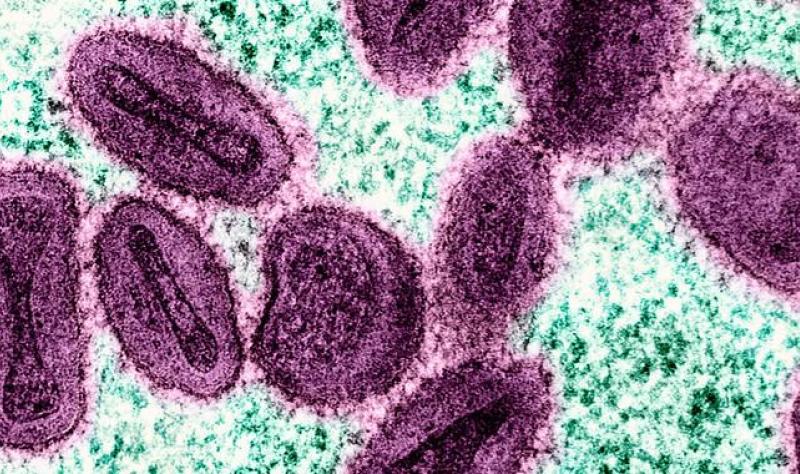 mpox virus