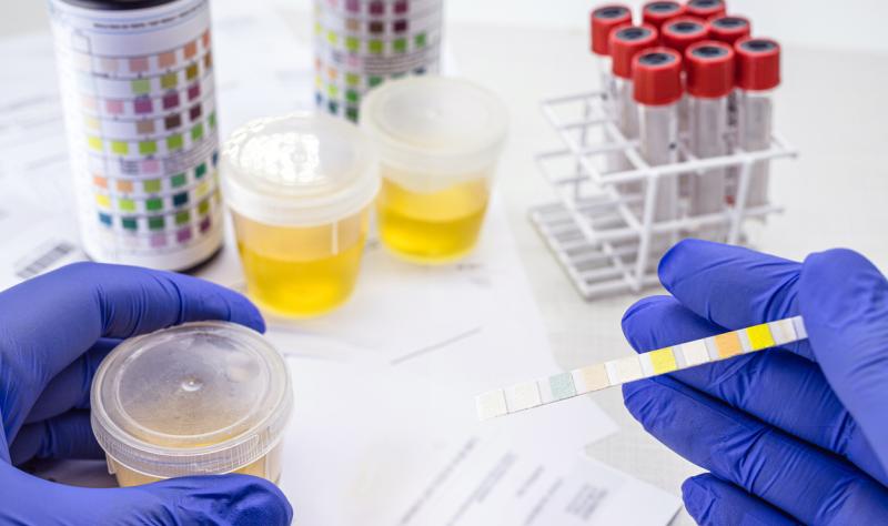 Urine testing